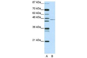 WB Suggested Anti-TRIM14 AntibodyTitration: 2. (TRIM14 anticorps  (N-Term))