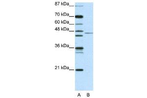 WB Suggested Anti-TRIM14 AntibodyTitration: 2. (TRIM14 anticorps  (N-Term))