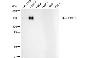 Western blotting analysis using EGFR antibody (ABIN7798479).