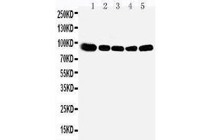 Anti-OSBP1 antibody, Western blotting Lane 1: Rat Kidney Tissue Lysate Lane 2: Rat Spleen Tissue Lysate Lane 3: Rat Lung Tissue Lysate Lane 4: HELA Cell Lysate Lane 5: A549 Cell Lysate (OSBP anticorps  (Middle Region))