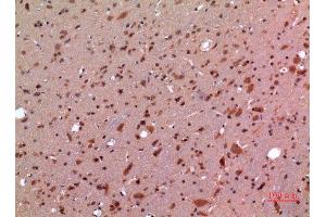 Immunohistochemistry (IHC) analysis of paraffin-embedded Rat Brain, antibody was diluted at 1:100.