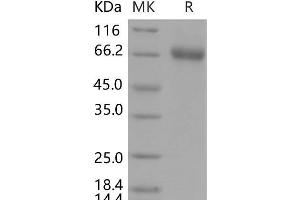 Western Blotting (WB) image for Ephrin Type A Receptor 1 (EPHA1) (Active) protein (His tag) (ABIN7195579)