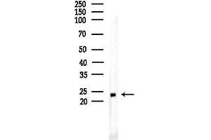 anti-MOB Kinase Activator 1B (MOB1B) (N-Term) antibody