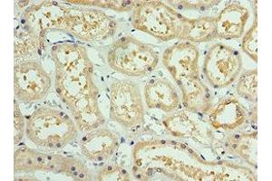 Immunohistochemistry of paraffin-embedded human kidney tissue using ABIN7142914 at dilution of 1:100 (AKAP8L anticorps  (AA 1-240))