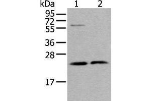 Western blot analysis of LO2 cell and Human testis tissue lysates using ABHD14B Polyclonal Antibody at dilution of 1:350 (ABHD14B anticorps)