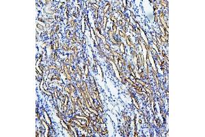 IHC analysis of MUC20 using anti-MUC20 antibody (ABIN6719588).