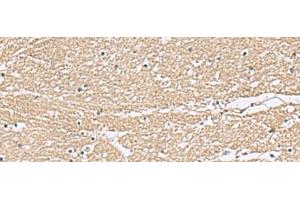 Immunohistochemistry of paraffin-embedded Human brain tissue using KCTD7 Polyclonal Antibody at dilution of 1:55(x200) (KCTD7 anticorps)