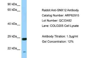 Western Blotting (WB) image for anti-Sorting Nexin 12 (SNX12) (Middle Region) antibody (ABIN2789294) (SNX12 anticorps  (Middle Region))