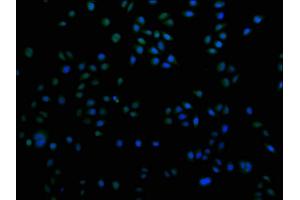 Immunofluorescence staining of Hela cells with ABIN7155485 at 1:100, counter-stained with DAPI.