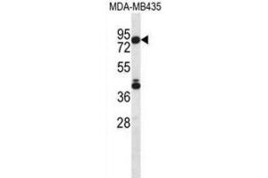 Western Blotting (WB) image for anti-Sphingosine-1-Phosphate Lyase 1 (SGPL1) antibody (ABIN2996917) (SGPL1 anticorps)