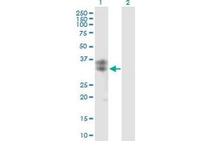 Western Blot analysis of CLEC5A expression in transfected 293T cell line by CLEC5A MaxPab polyclonal antibody. (CLEC5A anticorps  (AA 1-188))