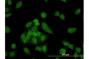 Immunofluorescence of monoclonal antibody to CNAP1 on HeLa cell. (NCAPD2 anticorps  (AA 1240-1339))