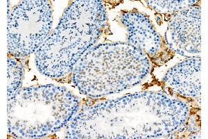 ABIN6265772 and ABIN6273336 at 1/100 staining Mouse testis tissue by IHC-P.