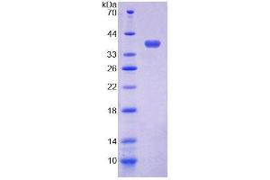 SDS-PAGE analysis of Horse ECF Protein. (ECF Protéine)