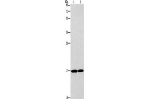 Western Blotting (WB) image for anti-Glia Maturation Factor, gamma (GMFG) antibody (ABIN2422817) (GMFG anticorps)