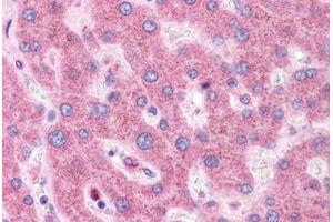 Human Liver: Formalin-Fixed, Paraffin-Embedded (FFPE)