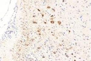 Immunohistochemistry analysis of paraffin-embedded rat brain using RASGRP3 (ABIN7075376) at dilution of 1: 1000 (RASGRP3 anticorps)