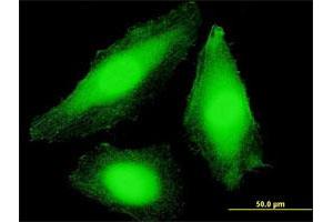 Immunofluorescence of purified MaxPab antibody to COPS7B on HeLa cell.