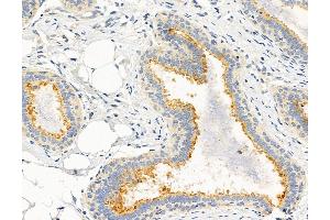 ABIN6264578 and ABIN6272979 at 1/100 staining Human normal tissues adjacent to breast cancer by IHC-P. (RAB3D anticorps  (Internal Region))