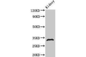 Western Blot Positive WB detected in: Rat kidney tissue All lanes: HIST1H1B antibody at 1 μg/mL Secondary Goat polyclonal to rabbit IgG at 1/50000 dilution Predicted band size: 23 kDa Observed band size: 32 kDa (Histone H1.5 anticorps  (pSer188))