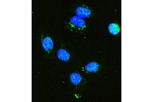 IF analysis of Hexokinase 1/HK1 using anti-Hexokinase 1/HK1 antibody (ABIN7600259).