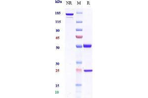 Anti-CSF2 / GM-CSF Reference Antibody (namilumab) on SDS-PAGE under reducing (R) condition. (Recombinant CSF2 (Namilumab Biosimilar) anticorps)