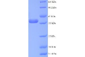 SDS-PAGE (SDS) image for Annexin A5 (ANXA5) (AA 2-320) protein (His tag) (ABIN5713230) (Annexin V Protein (AA 2-320) (His tag))