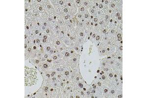 Immunohistochemistry of paraffin-embedded mouse liver using HIST1H2AG antibody (ABIN6003627) at dilution of 1/100 (40x lens).