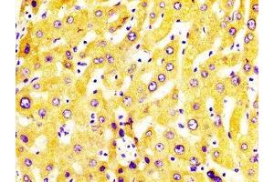IHC image of ABIN7149243 diluted at 1:400 and staining in paraffin-embedded human liver tissue performed on a Leica BondTM system.