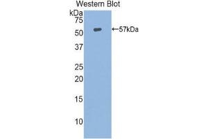 Western Blotting (WB) image for anti-Heat Shock 70kDa Protein 14 (HSPA14) (AA 1-509) antibody (ABIN1859210) (HSPA14 anticorps  (AA 1-509))