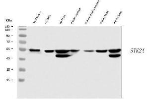 Western blot analysis of MST3/STK24 using anti-MST3/STK24 antibody (ABIN7599389).