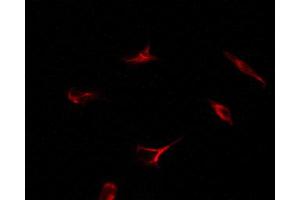 ABIN6269080 staining 293 by IF/ICC. (Estrogen Receptor alpha anticorps  (C-Term))