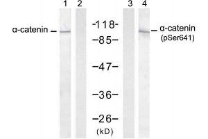 Western blot analysis of extract from A431 cells untreated or treated with EGF (200ng/ml, 30min), using α-catenin (Ab-641) antibody (E021330, Lane 1 and 2) and α-catenin (Phospho-Ser641) antibody (E011330, Lane 3 and 4). (CTNNA1 anticorps)