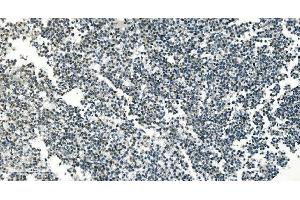 anti-Peptidase Inhibitor 16 (PI16) (AA 28-363) antibody