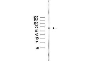 Western blot analysis of lysates from Rat liver, using Phospho-CaMKII (Tyr231) Antibody at 1/1000 dilution.