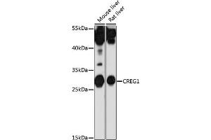 Western blot analysis of extracts of various cell lines, using CREG1 antibody (ABIN7266268) at 1:1000 dilution. (CREG1 anticorps  (AA 110-190))