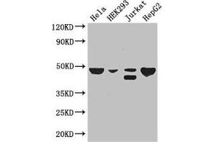 Western Blot Positive WB detected in: Hela whole cell lysate, HEK293 whole cell lysate, Jurkat whole cell lysate, HepG2 whole cell lysate All lanes: PLIN3 antibody at 3 μg/mL Secondary Goat polyclonal to rabbit IgG at 1/50000 dilution Predicted band size: 48, 29, 47, 46 kDa Observed band size: 48, 46 kDa (PLIN3 anticorps  (AA 192-324))