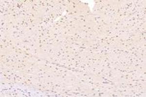 Immunohistochemistry analysis of paraffin-embedded ratheartusing,ZNF154 (ABIN7076261) at dilution of 1:4000 (ZNF154 anticorps)