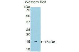 Western Blotting (WB) image for anti-Klotho beta (KLB) (AA 517-636) antibody (ABIN1176668) (Klotho beta anticorps  (AA 517-636))