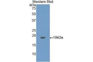 Western Blotting (WB) image for anti-Lysophosphatidylcholine Acyltransferase 3 (LPCAT3) (AA 122-233) antibody (ABIN1176546)