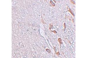 Immunohistochemistry (IHC) image for anti-Leucine Rich Repeat Transmembrane Neuronal 1 (LRRTM1) (C-Term) antibody (ABIN1030496) (LRRTM1 anticorps  (C-Term))