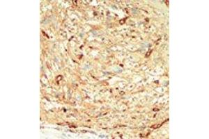 Image no. 1 for anti-serine/threonine Kinase 4 (STK4) (C-Term) antibody (ABIN360312)