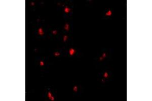 Immunofluorescence of CBL in human lymph node tissue with CBL polyclonal antibody  at 20 ug/mL . (CBL anticorps  (C-Term))