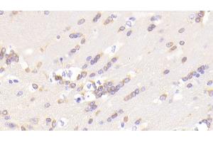 Detection of LRDD in Mouse Cerebrum Tissue using Polyclonal Antibody to Leucine Rich Repeats And Death Domain Containing Protein (LRDD) (PIDD anticorps  (AA 666-915))
