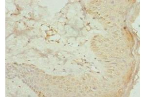 Immunohistochemistry of paraffin-embedded human skin tissue using ABIN7142022 at dilution of 1:100 (AGPAT2 anticorps  (AA 199-278))