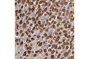 Immunohistochemical staining of human stomach with SRD5A3 polyclonal antibody  shows strong cytoplasmic positivity in subset of glandular cells. (SRD5A3 anticorps)