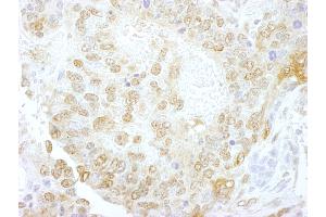 Immunohistochemistry (IHC) image for anti-Nuclear Cap Binding Protein Subunit 1, 80kDa (NCBP1) (AA 482-532) antibody (ABIN7448681) (NCBP1 anticorps  (AA 482-532))