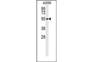 Lane 1: A2058 Cell lysates, probed with MMP14 (133CT15.