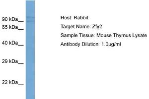 Host:  Rabbit  Target Name:  Zfy2  Sample Type:  Mouse Thymus lysates  Antibody Dilution:  1. (ZFY2 anticorps  (Middle Region))