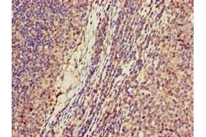 Immunohistochemistry of paraffin-embedded human lymph node tissue using ABIN7157644 at dilution of 1:100 (KIF2A anticorps  (AA 5-308))